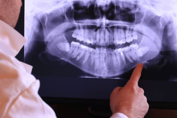 Best Emergency Tooth Extraction  in Warr Acres, OK